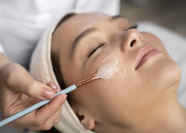 peeling quimico